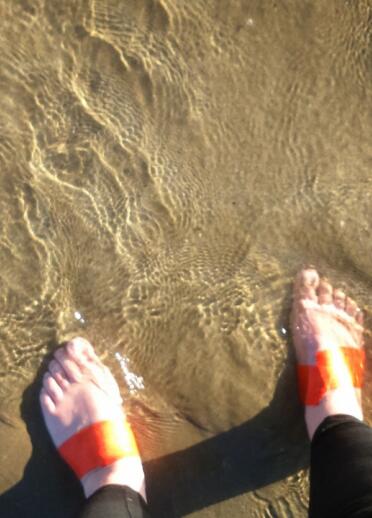 Blick auf die nackten, mit Blasen übersäten Füße, die ins kühle Meer getaucht werden.
